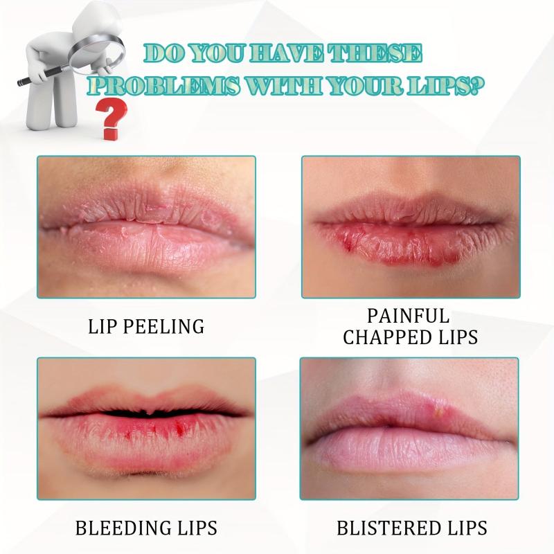 20g Lip Repair Cream Lip Balm Hydrating Prevent Dry Cracked Lips