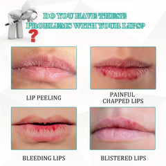 20g Lip Repair Cream Lip Balm Hydrating Prevent Dry Cracked Lips