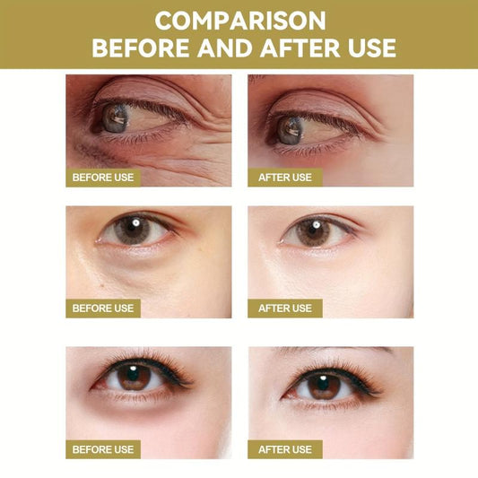 Moisturizing Eye Mask Reduces Dark Circles Tightens Bags Smoothes Skin