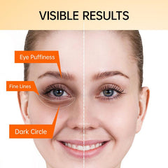 Vitamin C Eye Cream Moisturizing Brightening Massager Eye Serum 20ml