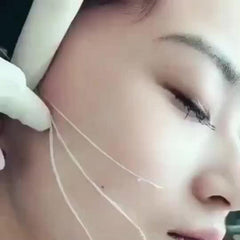 120Pcs Protein Thread No Needle Golden Collagen Facial Lift Tightening