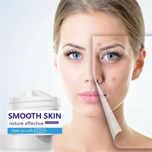 30ml Acne Removing Cream - Face Smoothing & Repairing