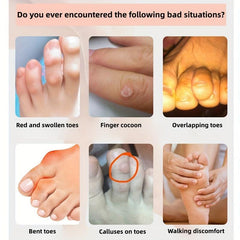 Silicone Toe Protector Foot Care Pinky Tube Bunion Corrector