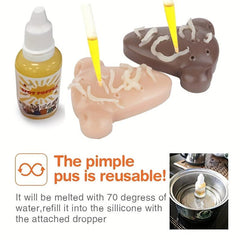 Nose Model Squeeze Acne Toy Pimple Popper Stress Reliever