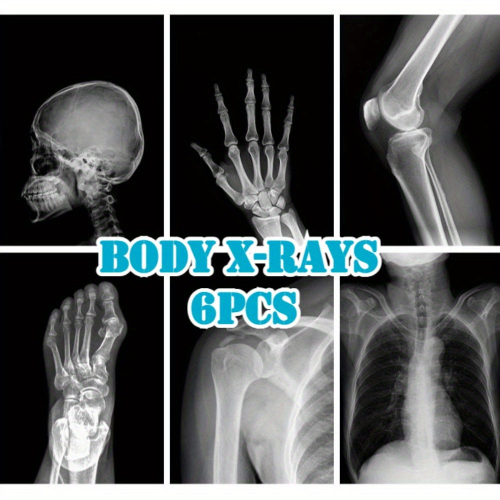 X-Ray Film Set for Human and Animal Science Study