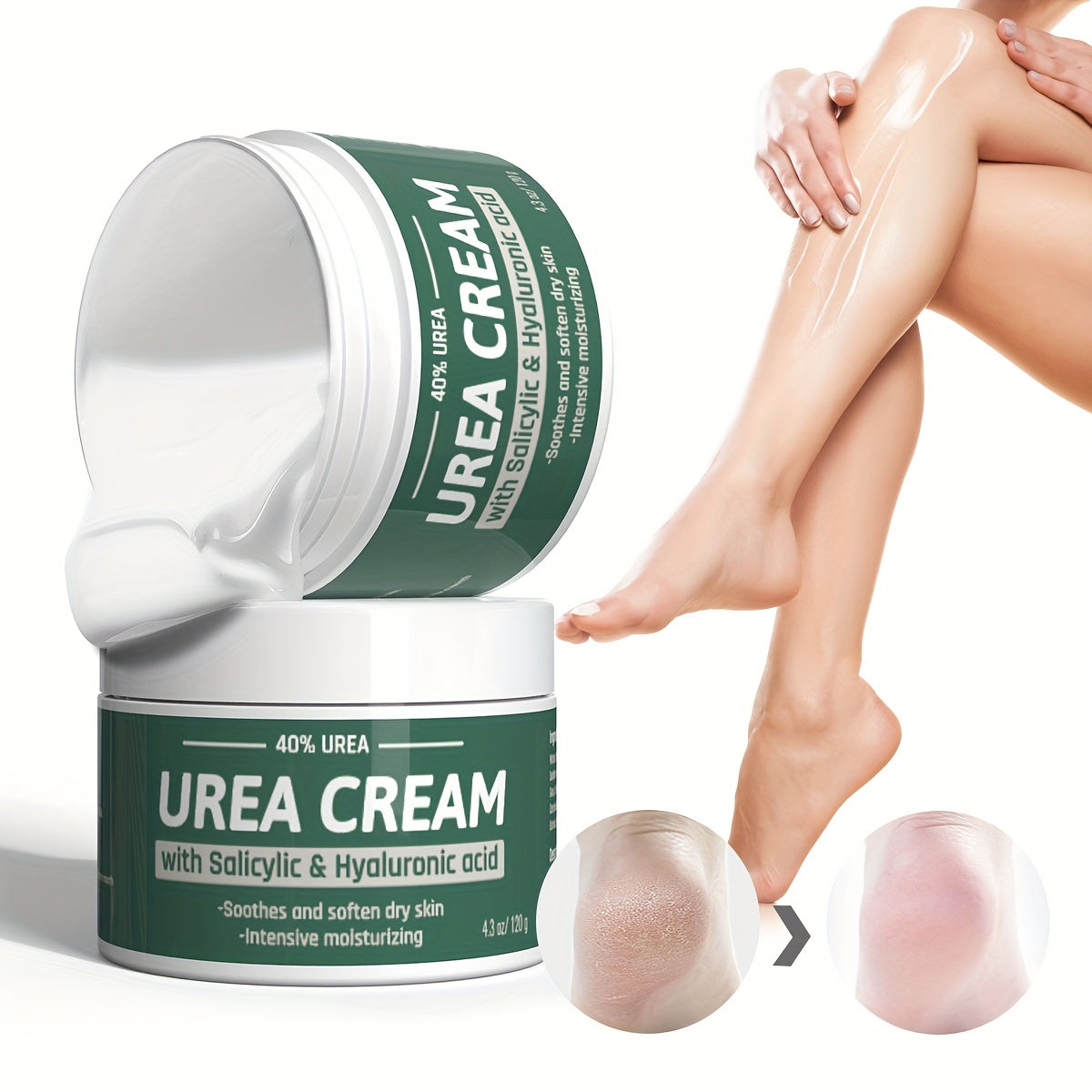 Urea Cream 40% Moisturize Skin For Dry Cracked Feet Hands Heels