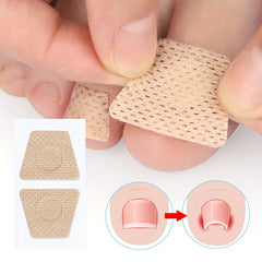 Toe Nail Patches Nighttime Renewal - Fast Ingrown Nail Correction
