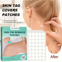 Acne Patches Hydrocolloid Acne Pimple Patch 120pcs