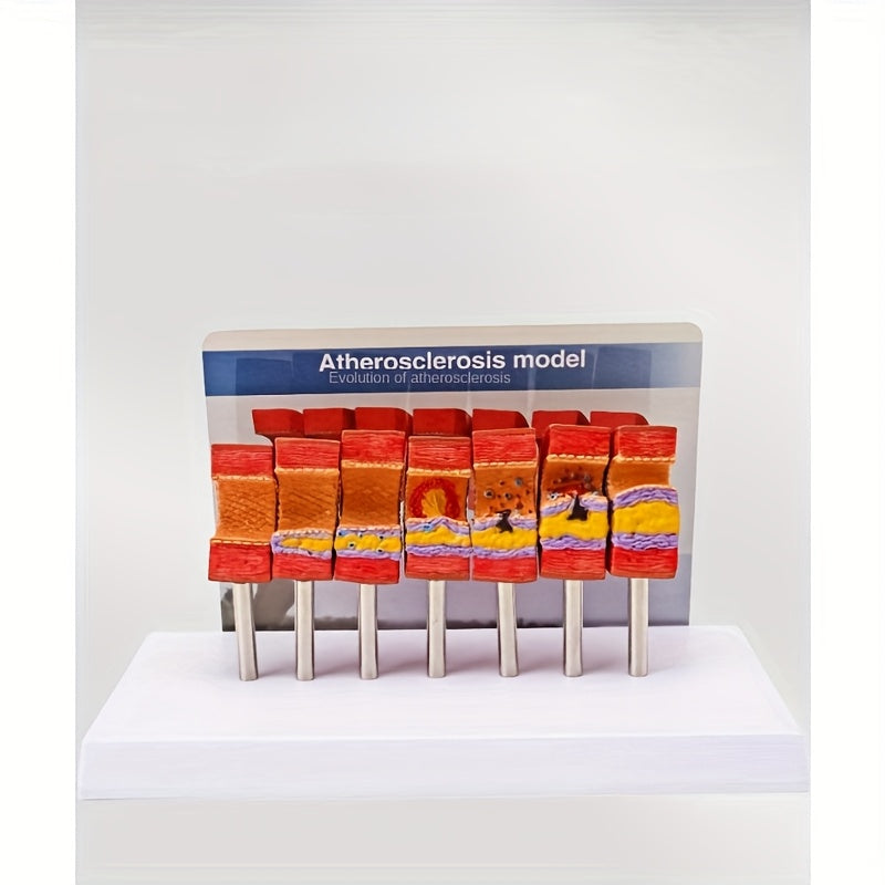 Educational Arterial Sclerosis Model for Students