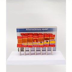 Educational Arterial Sclerosis Model for Students