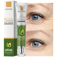 Retinol Eye Cream for Dark Circles and Fine Lines