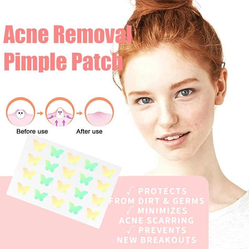 100Pcs Invisible Acne Removal Pimple Patch Butterfly Shape Beauty Tools