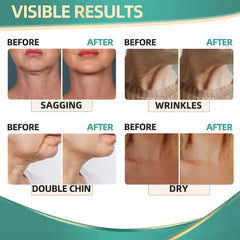 Retinol & Collagen Neck Firming Cream for Wrinkles