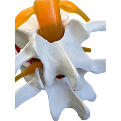 1pc Spine and Disc Model Lumbar Vertebrae Demonstration Teaching Aid