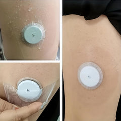 Silicon Dynamic Patches for Electronic Blood Glucose Sensors